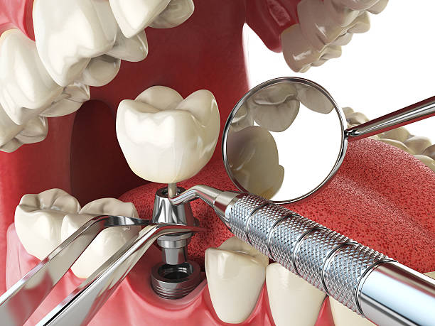 Best Emergency Treatment for Jaw Pain or Injury in Hillcrest Heights, MD